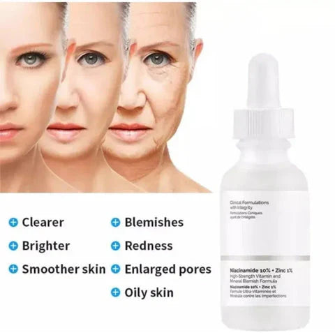 The Ordinary 30ml Serum | Niacinamide 10% + Zinc 1% for Clear, Balanced Skin | Oil Control, Pore Minimizing & Blemish Solution Serum