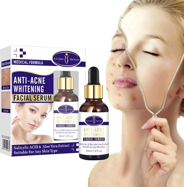 Aichun Beauty Whitening & Anti-Acne Serum | Aloe Vera & Salicylic Acid | 30ml Skin Brightening Formula