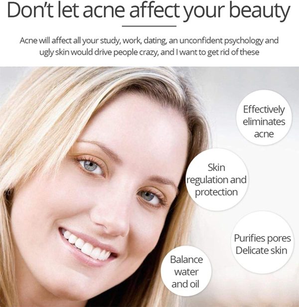Aichun Beauty Whitening & Anti-Acne Serum | Aloe Vera & Salicylic Acid | 30ml Skin Brightening Formula
