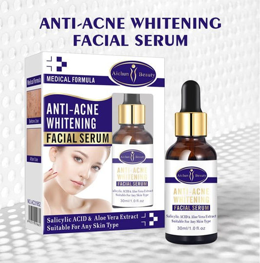 Aichun Beauty Whitening & Anti-Acne Serum | Aloe Vera & Salicylic Acid | 30ml Skin Brightening Formula
