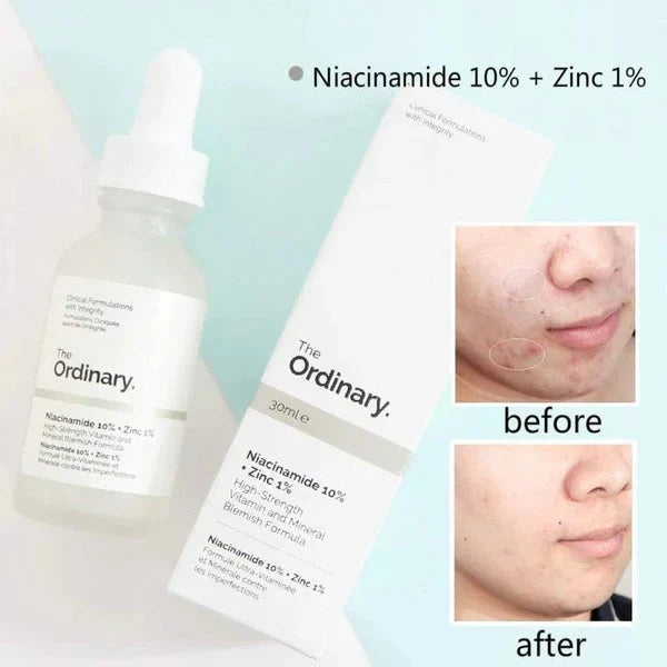 The Ordinary 30ml Serum | Niacinamide 10% + Zinc 1% for Clear, Balanced Skin